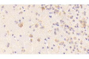 Detection of TFR in Mouse Cerebrum Tissue using Polyclonal Antibody to Transferrin Receptor (TFR) (Transferrin Receptor 抗体  (AA 572-757))