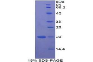 SDS-PAGE analysis of Human MFAP5 Protein. (MFAP5 蛋白)