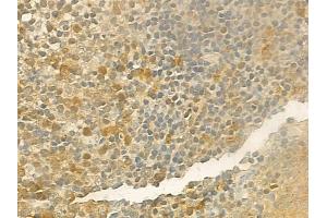 ABIN6257284 and ABIN6274172 at 1/100 staining human normal tonsil tissue by IHC-P. (IRF2 抗体  (Internal Region))