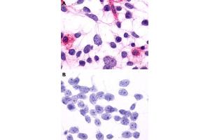 Immunocytochemistry (ICC) staining of HEK293 human embryonic kidney cells transfected (A) or untransfected (B) with RHO. (Rho-related GTP-binding protein 抗体  (2nd Extracellular Domain))