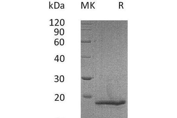 COL18A1 Protein (His tag)