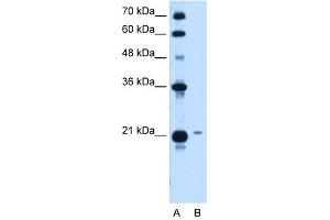 TCP10L antibody used at 1. (TCP10L 抗体)