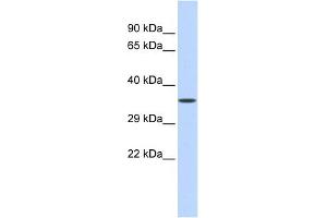 WB Suggested Anti-ZNF124 Antibody Titration:  0. (ZNF124 抗体  (Middle Region))