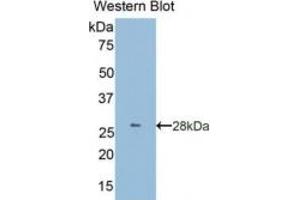 WB of Protein Standard: different control antibodies against Highly purified E. (Granulin CLIA Kit)