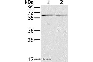 Western blot analysis of Mouse liver and lung tissue, using PTGER2 Polyclonal Antibody at dilution of 1:200 (PTGER2 抗体)