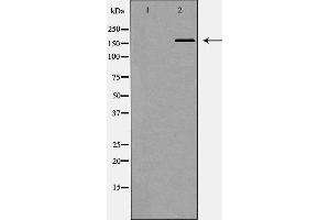 Western blot analysis of Hepg2 whole cell lysates, using SMARCA4 Antibody. (SMARCA4 抗体  (N-Term))