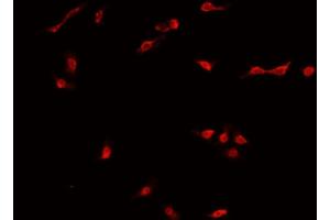 ABIN6269035 staining MCF-7 cells by IF/ICC. (DNMT3B 抗体  (N-Term))