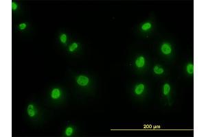 Immunofluorescence of monoclonal antibody to SMAD2 on HeLa cell. (SMAD2 抗体  (AA 181-280))