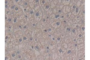 DAB staining on IHC-P; Samples: Human Liver Tissue (Interferon gamma 抗体  (AA 24-166))