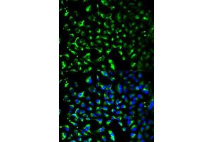 Immunofluorescence analysis of HeLa cells using PHB antibody. (Prohibitin 抗体  (AA 73-272))