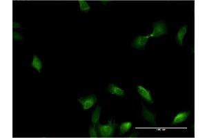 Immunofluorescence of monoclonal antibody to IL1A on HeLa cell. (IL1A 抗体  (AA 172-271))