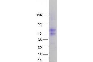 Validation with Western Blot