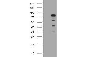 Image no. 1 for anti-Myotubularin Related Protein 2 (MTMR2) antibody (ABIN1499592) (MTMR2 抗体)