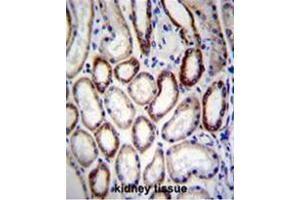Immunohistochemistry (Paraffin-embedded Sections) (IHC (p)) image for anti-Branched Chain Amino-Acid Transaminase 2, Mitochondrial (BCAT2) (AA 308-336), (C-Term) antibody (ABIN950618)