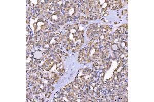 IHC analysis of TOM1L1 using anti-TOM1L1 antibody (ABIN7602631). (TOM1L1 抗体  (AA 9-448))