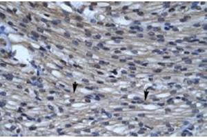 Immunohistochemical staining (Formalin-fixed paraffin-embedded sections) of human heart with CLIC5 polyclonal antibody  at 4-8 ug/mL working concentration. (CLIC5 抗体  (C-Term))