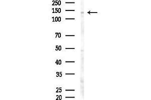 anti-Palladin, Cytoskeletal Associated Protein (PALLD) (Internal Region) antibody