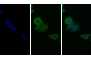 Detection of PAI1 in Human Hela cell using Monoclonal Antibody to Plasminogen Activator Inhibitor 1 (PAI1) (PAI1 抗体)