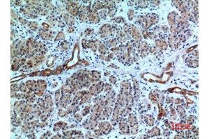 Immunohistochemistry (IHC) analysis of paraffin-embedded Human Pancreas, antibody was diluted at 1:100. (CXCR6 抗体  (N-Term))