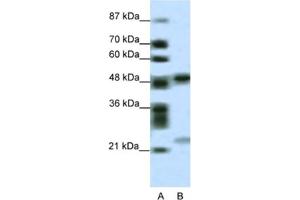 Western Blotting (WB) image for anti-PHD Finger Protein 11 (PHF11) antibody (ABIN2461063) (PHF11 抗体)