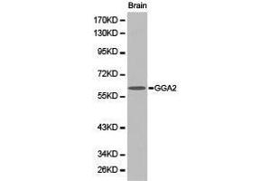 Western Blotting (WB) image for anti-Golgi-Associated, gamma Adaptin Ear Containing, ARF Binding Protein 2 (GGA2) antibody (ABIN1872807) (GGA2 抗体)