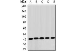 Western blot analysis of STK19 expression in Jurkat (A), HepG2 (B), mouse liver (C), rat lung (D), rat brain (E) whole cell lysates. (STK19 抗体)