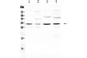 Western blot analysis of Aquaporin 3 using anti- Aquaporin 3 antibody . (AQP3 抗体  (Middle Region))