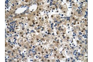 SQLE antibody was used for immunohistochemistry at a concentration of 4-8 ug/ml. (SQLE 抗体  (C-Term))