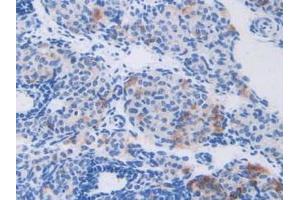 Detection of CAPN1 in Mouse Ovary Tissue using Polyclonal Antibody to Calpain 1 (CAPN1)