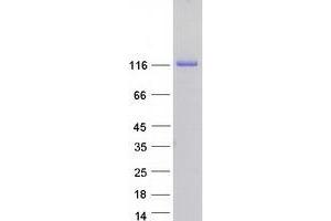 Western Blotting (WB) image for Junction Mediating and Regulatory Protein, P53 Cofactor (JMY) protein (Myc-DYKDDDDK Tag) (ABIN2723940)