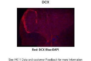 Sample Type :  Mouse spinal cord  Primary Antibody Dilution :  1:300  Secondary Antibody :  Anti-rabbit-Alexa 594  Secondary Antibody Dilution :  1:500  Color/Signal Descriptions :  Red: DCX Blue:DAPI  Gene Name :  DCX  Submitted by :  Anonymous (Doublecortin 抗体  (C-Term))