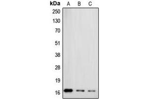 Western blot analysis of Gamma-synuclein expression in MCF7 (A), HT29 (B), HeLa (C) whole cell lysates. (SNCG 抗体  (C-Term))