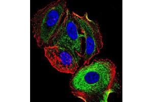 Immunofluorescence analysis of MCF-7 cells using ATF3 mouse mAb (green).