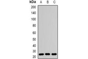Western blot analysis of RAB5A expression in Hela (A), PC12 (B), mouse brain (C) whole cell lysates. (RAB5 抗体)