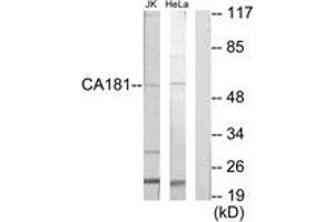 Western blot analysis of extracts from Jurkat/HeLa cells, using CA181 Antibody. (CA181 (AA 301-350) 抗体)