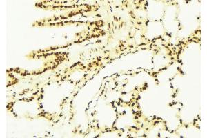 ABIN6273091 at 1/100 staining Mouse lung tissue by IHC-P. (ALDH7A1 抗体  (C-Term))