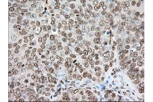 Immunohistochemical staining of paraffin-embedded Human colon tissue using anti-CYP1A2 mouse monoclonal antibody. (CYP1A2 抗体)