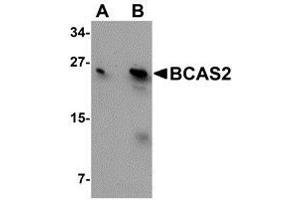 Western blot analysis of BCAS2 in MCF7 cell lysate with AP30126PU-N BCAS2 antibody at (A) 0. (BCAS2 抗体  (C-Term))