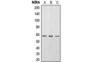 Western Blotting (WB) image for anti-Signal Transducing Adaptor Molecule (SH3 Domain and ITAM Motif) 2 (STAM2) (pTyr192) antibody (ABIN7297494)