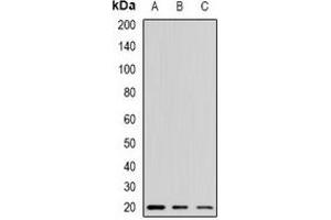 Western blot analysis of Alpha-crystallin A expression in mouse kidney (A), mouse liver (B), mouse heart (C) whole cell lysates. (CRYAA 抗体)