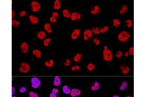 Immunofluorescence (IF) image for anti-Methyltransferase Like 3 (METTL3) antibody (ABIN7264399)