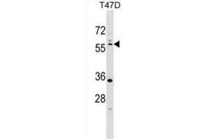 Western Blotting (WB) image for anti-serine/threonine Kinase 11 (STK11) antibody (ABIN3003070) (LKB1 抗体)