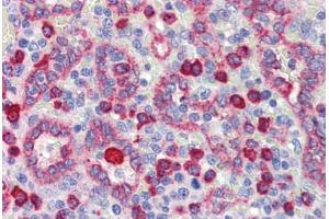 Human Spleen (formalin-fixed, paraffin-embedded) stained with NR2C1 antibody ABIN462209 followed by biotinylated goat anti-rabbit IgG secondary antibody ABIN481713, alkaline phosphatase-streptavidin and chromogen. (NR2C1 抗体  (N-Term))