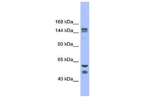 WB Suggested Anti-FBXL10 Antibody Titration: 0. (KDM2B 抗体  (Middle Region))