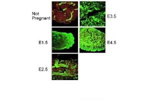 Immunohistochemistry (IHC) image for anti-Porcupine Homolog (PORCN) (N-Term) antibody (ABIN2783888)