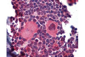 IHC Information: Paraffin embedded mouse lymphoid tissue (skeletal muscle) tissue, tested with an antibody dilution of 5 ug/ml. (NK2 Homeobox 3 抗体  (C-Term))