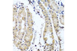 Immunohistochemistry of paraffin-embedded human stomach using COL9A1 antibody at dilution of 1:100 (40x lens).