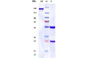 Anti-AA2AR / Adenosine A2aR Reference Antibody (3F6-9G5) on SDS-PAGE under reducing (R) condition.