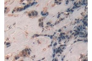Immunohistochemistry (IHC) image for anti-SP100 Nuclear Antigen (SP100) (AA 610-802) antibody (ABIN7442741)