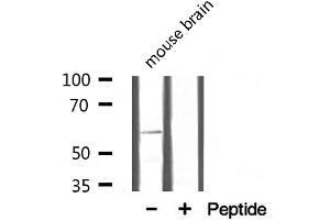 Western blot analysis on mouse brain lysate using Osteopontin Antibody (Osteopontin 抗体  (C-Term))